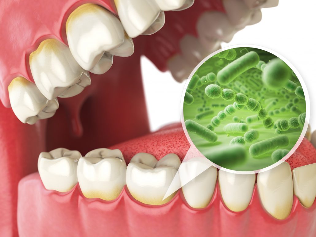 İzmir Diş Eti Hastalıkları (Periodontoloji) Dentomega